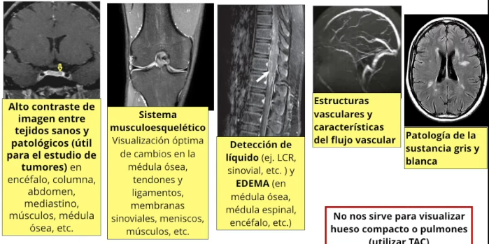 <ul><li><p>La más utilizada es la visualización detallada del encéfalo para cualquier tipo de patología</p></li><li><p><span style="color: red"><strong>No sirve para ver el parénquima pulmonar</strong></span></p></li></ul><p></p>