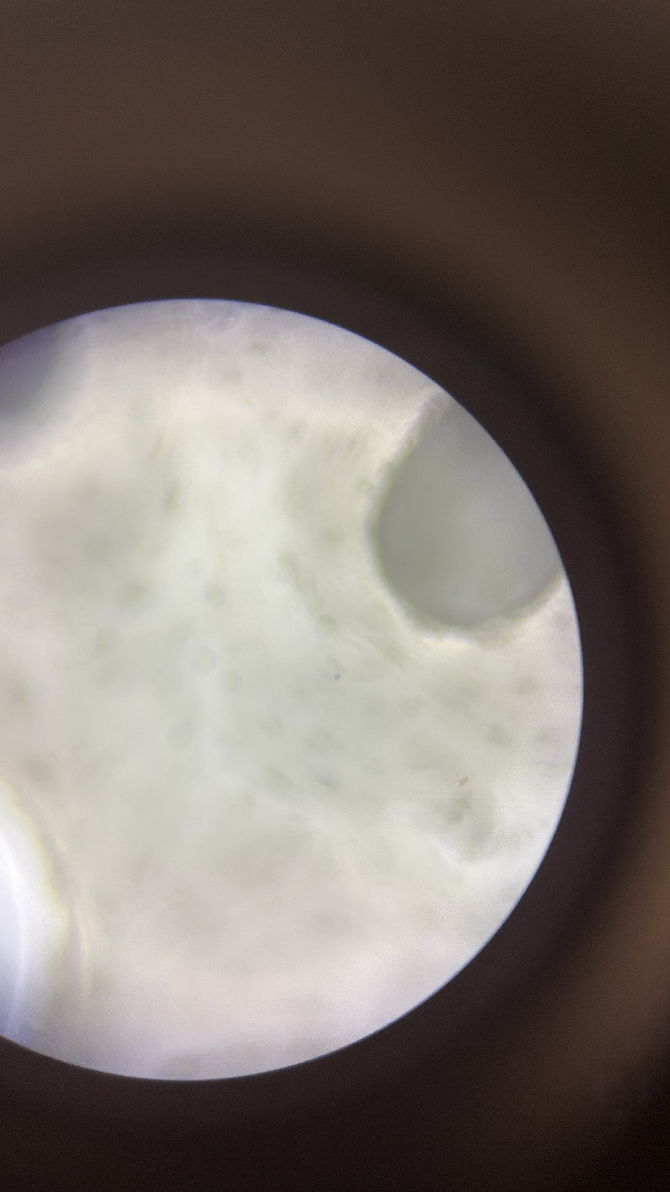 <p>What is the magnification level of the Bone?</p>