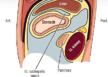 <p>Between inferior surface of liver and stomach </p>