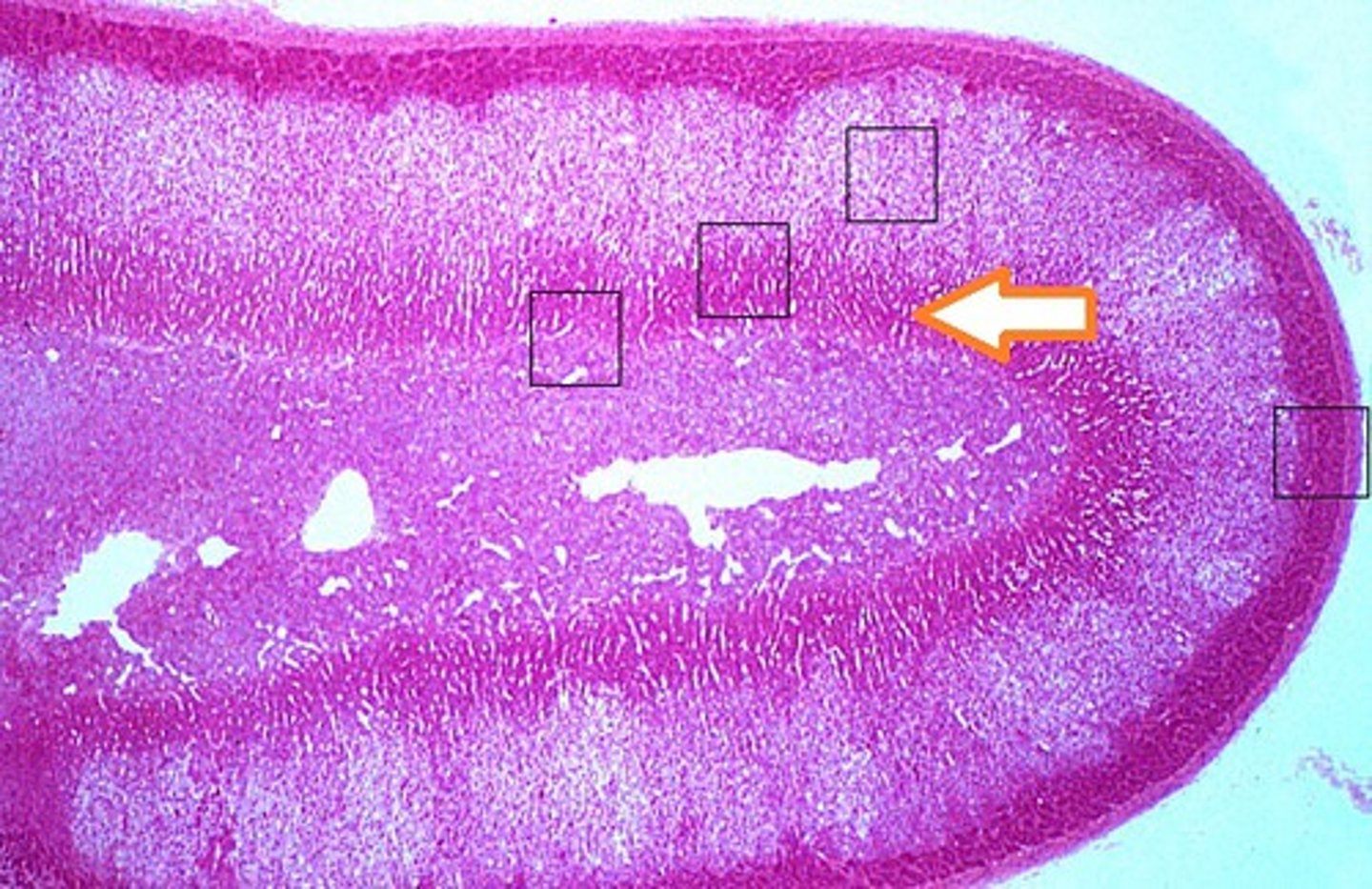 <p>What zone of the adrenal cortex:</p><p>-makes weak androgens</p><p>-stimulated by ACTH</p>