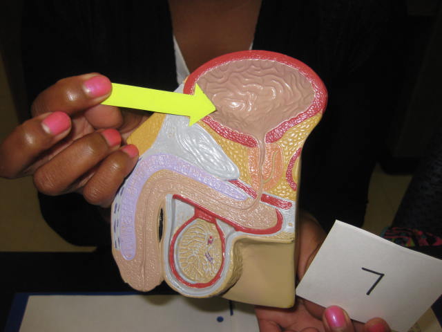 <p>Body Cavities and Body Systems</p><p>Lab Image 1-14</p>