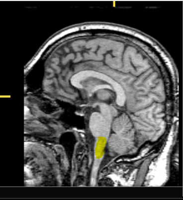 <p>What part of the brain is highlighted?</p>