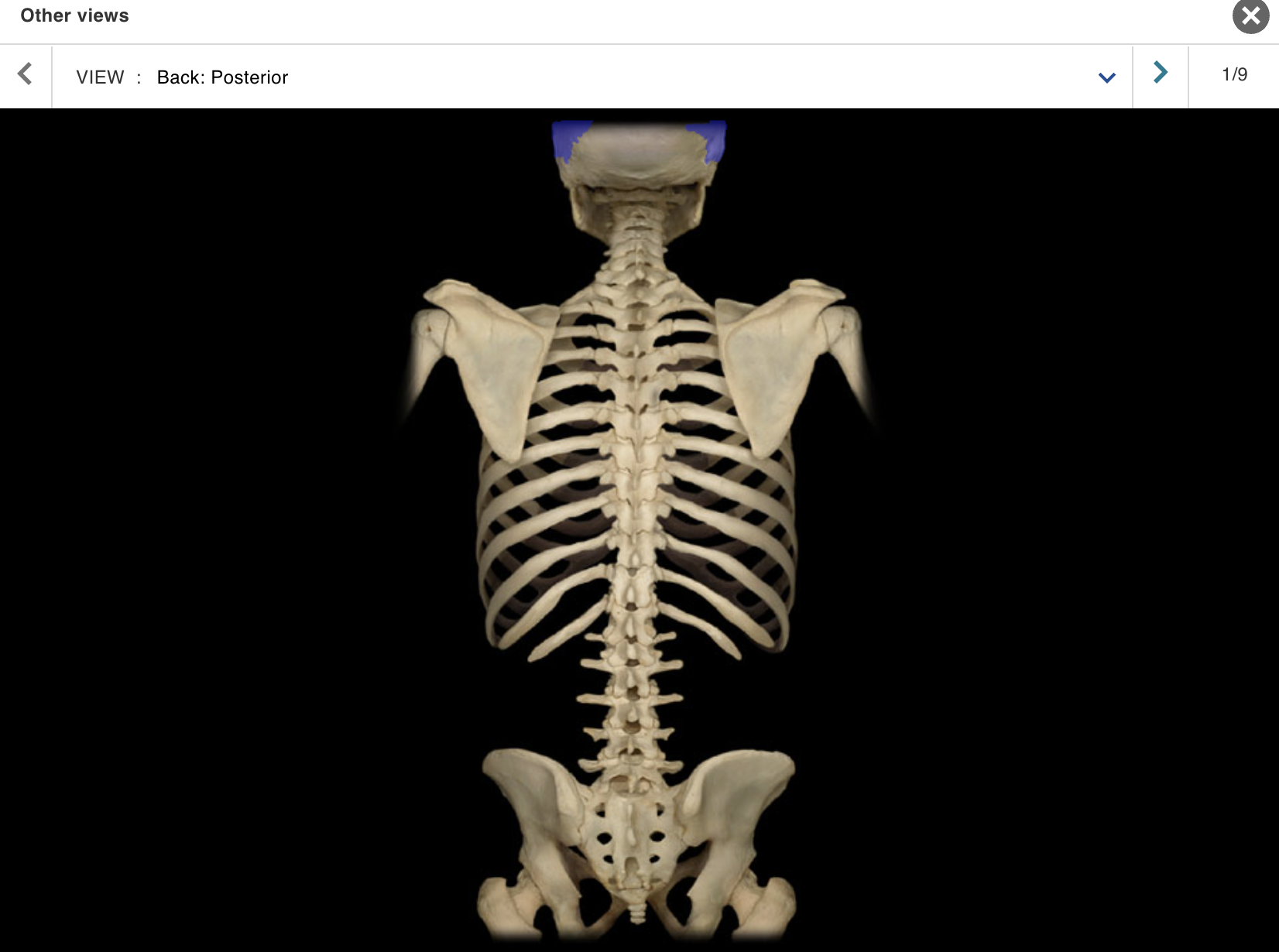 <p>Location:</p><p class="p1">• Skull (lateral)</p><p class="p1">Description:</p><ul><li><p>﻿﻿Paired, flat bone</p></li><li><p>﻿﻿Forms most of lateral skull</p></li></ul><p class="p1">Comment:</p><ul><li><p>﻿﻿Parietal bones articulate at sagittal suture (midline)</p></li><li><p>﻿﻿Articulates with frontal bone at coronal suture, occipital bone at lambdoid suture, and temporal bone at squamosal suture</p></li></ul><p></p>