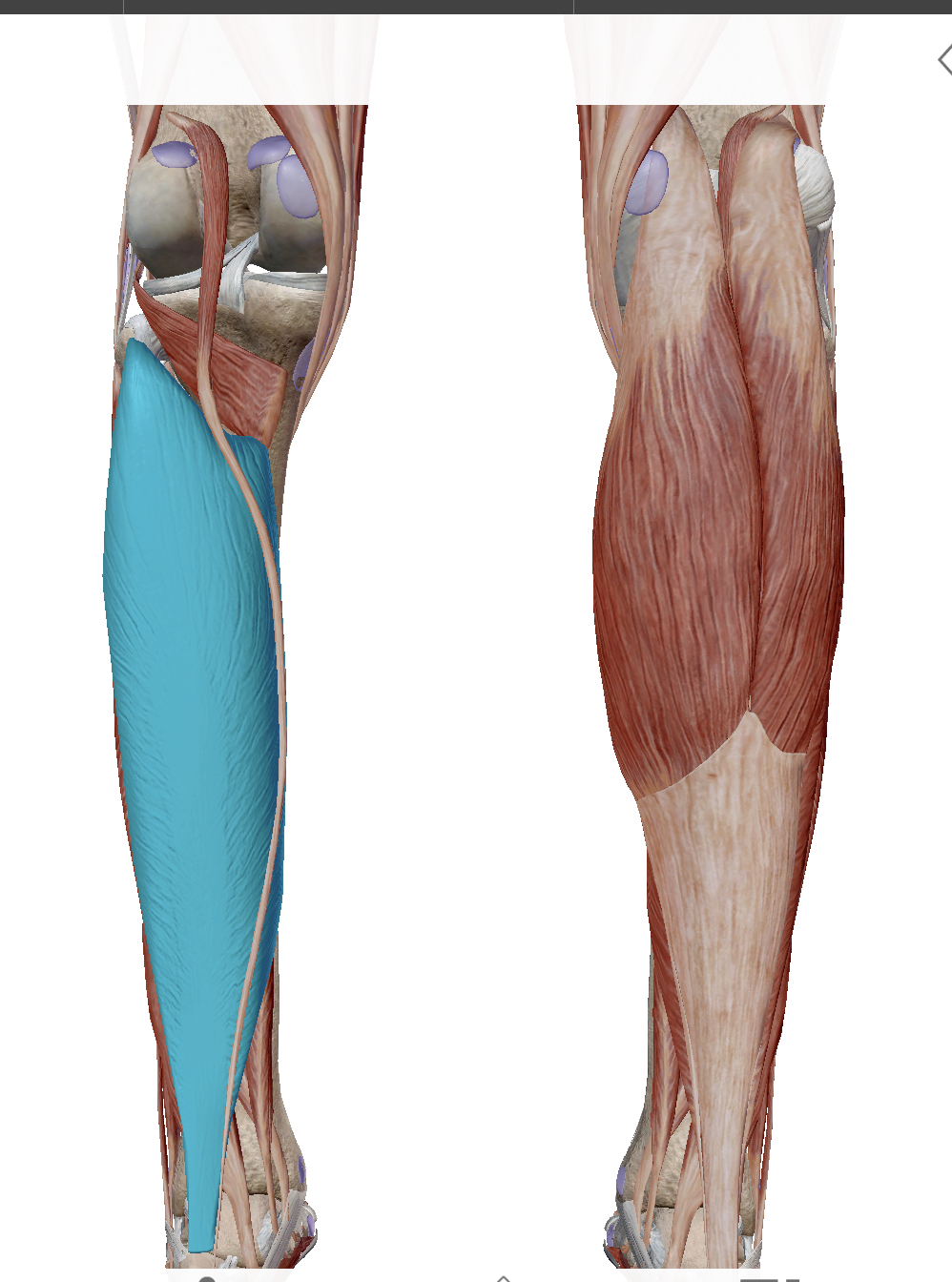 <p>Identify the highlighted muscle</p>