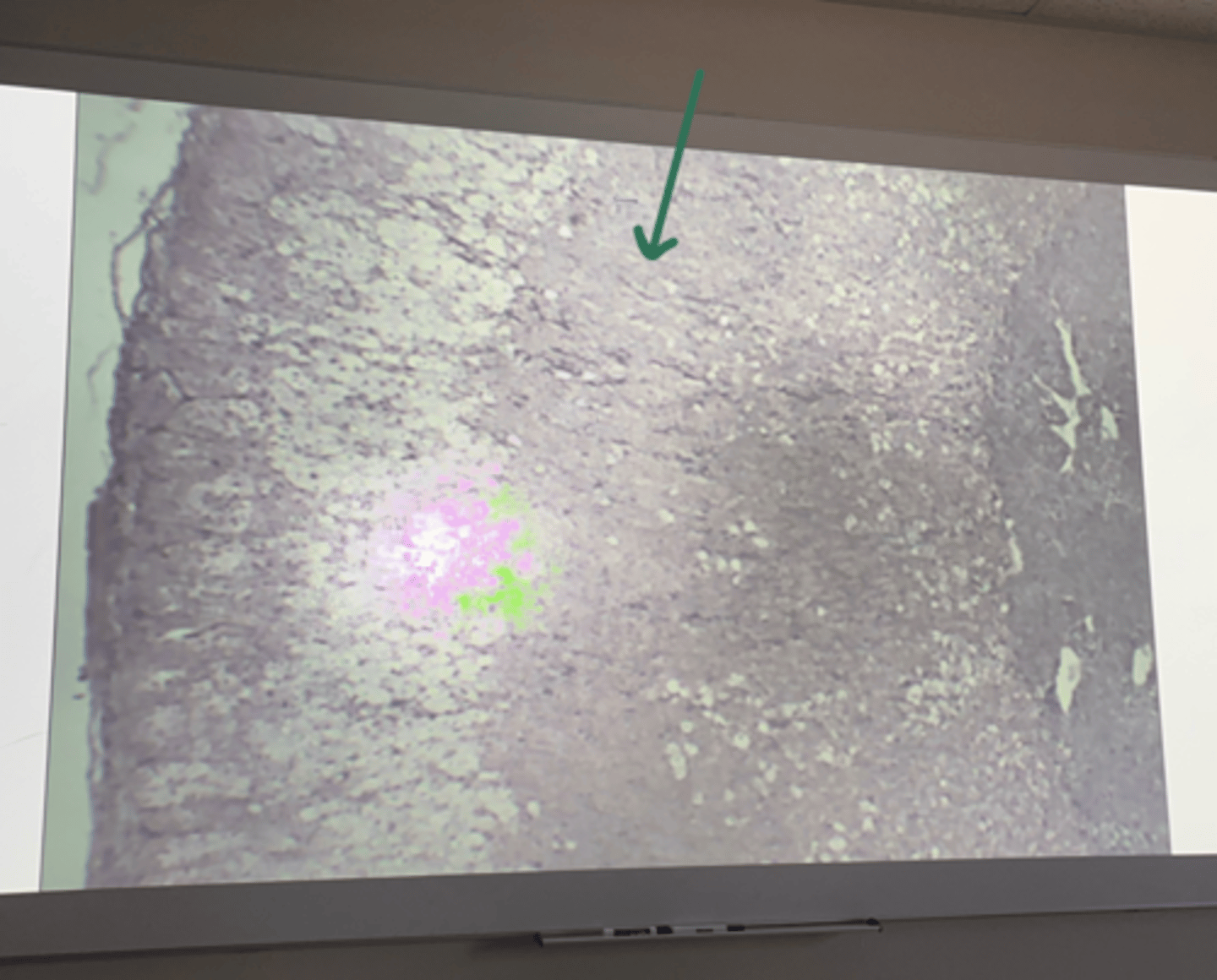 <p>gland and structure</p>