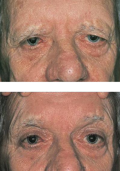 <p><strong>Lift the brow</strong></p>