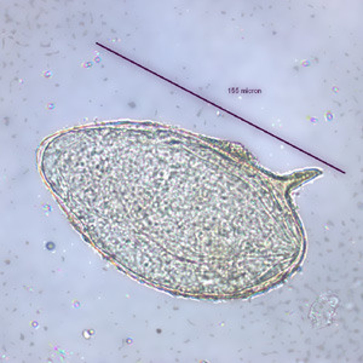 <p>The Schistosoma species with a prominent lateral spine is</p>
