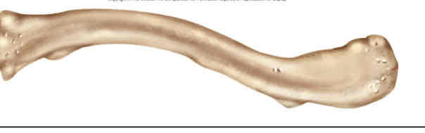 <p>Identify this bone </p>