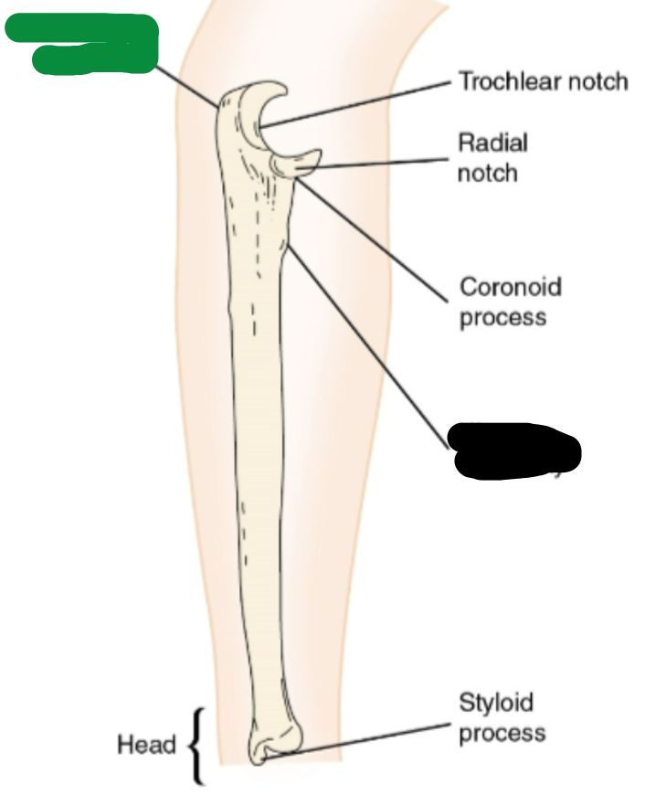 <p>this is a picture of the elbow and ulna</p>