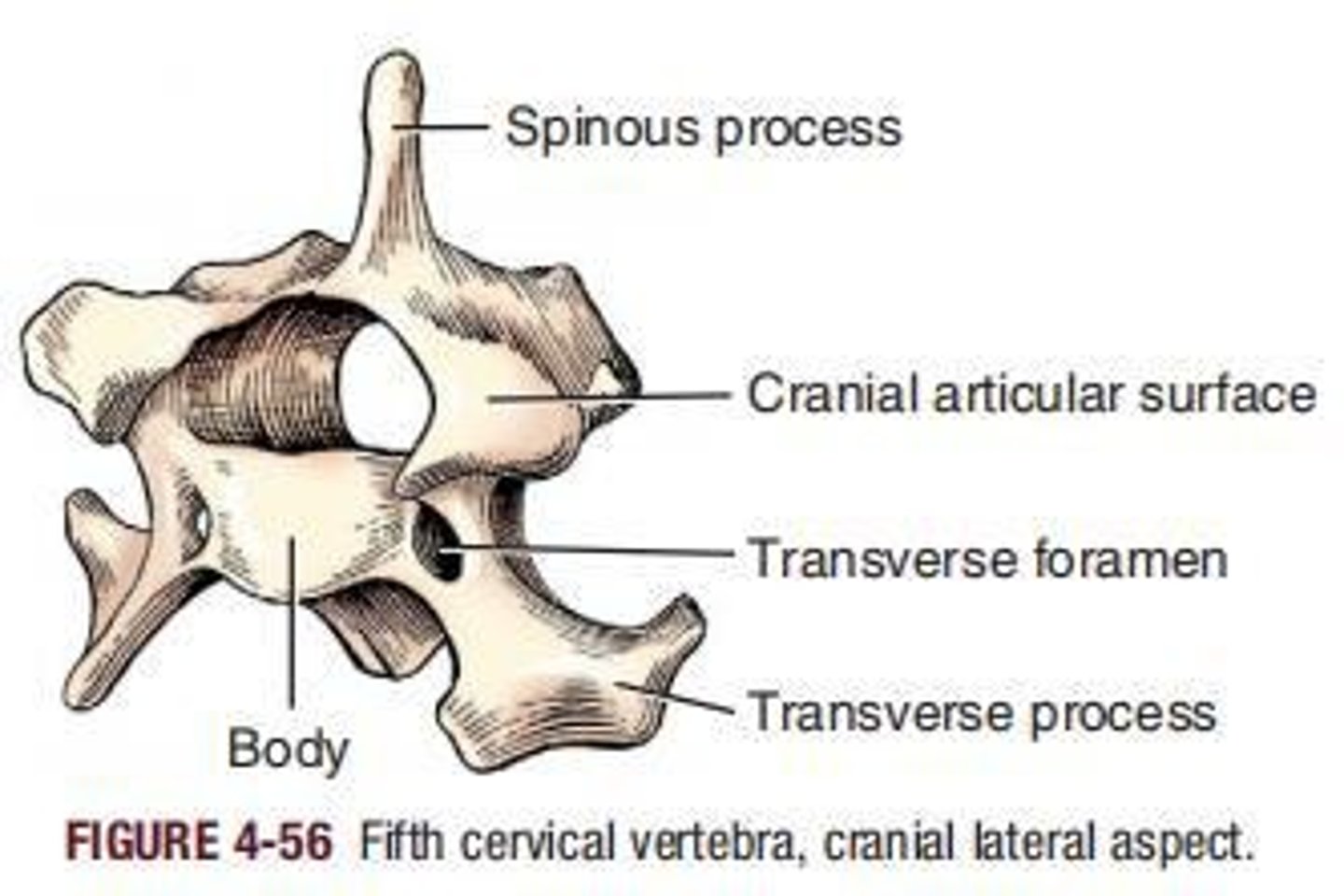 <p>Longest spinous process among cervical vertebrae.</p>