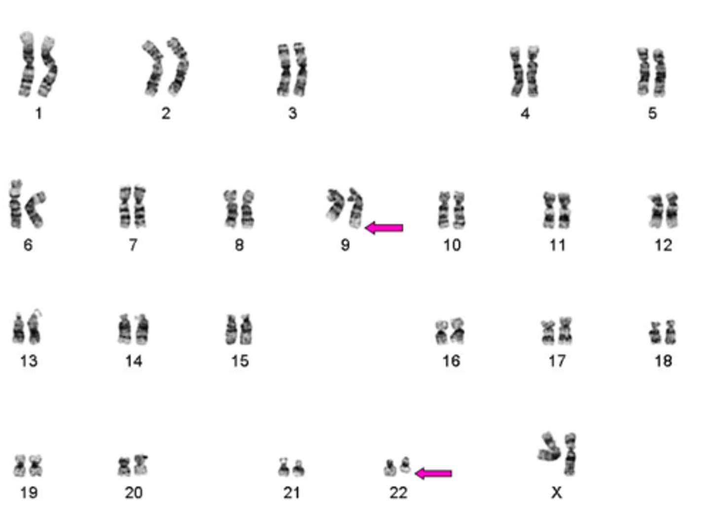 <p>based on the karyotype, identify the genetic disorder:</p>