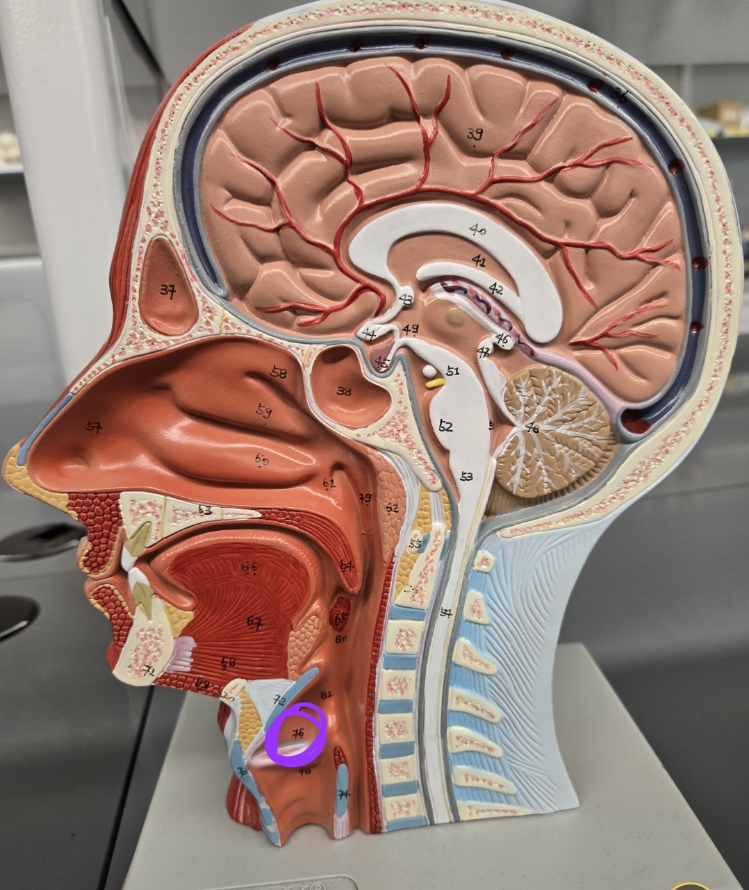 <p>Half head model: what structure is this?</p>
