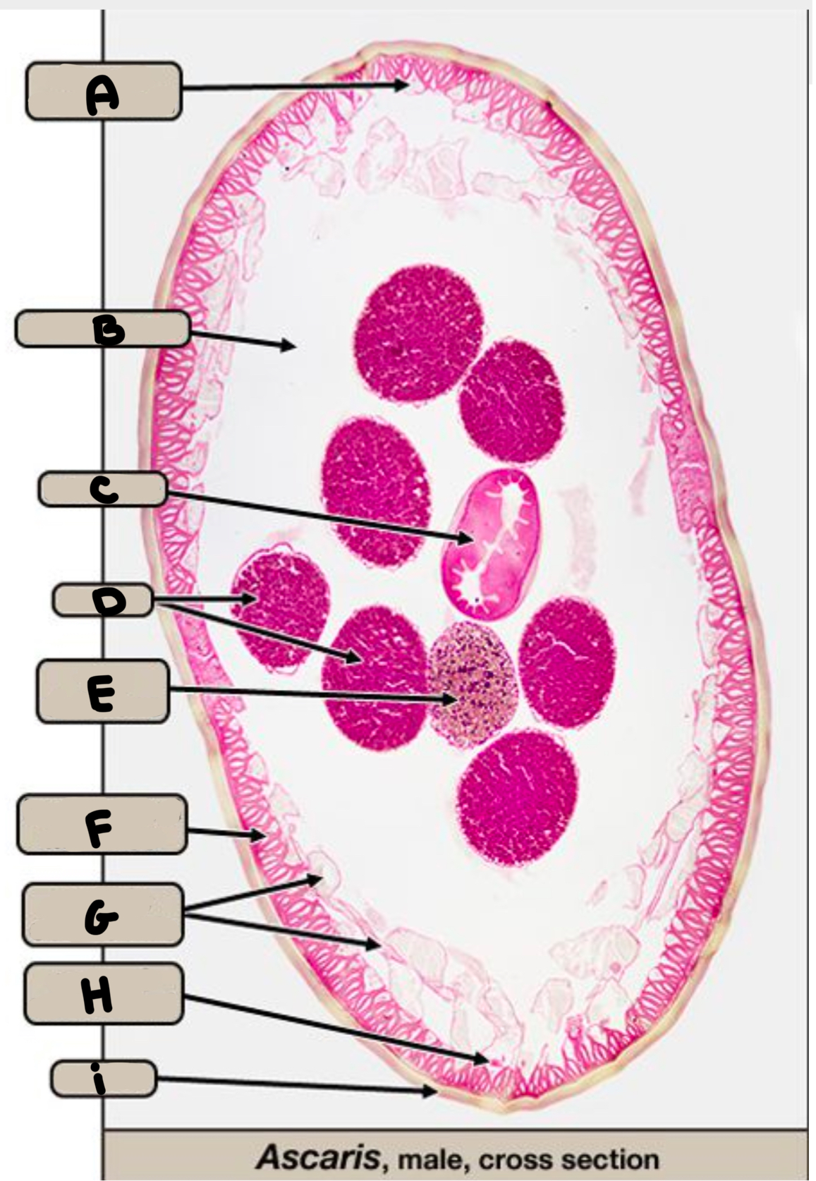 <p>What part of the ascaris is labeled A</p>