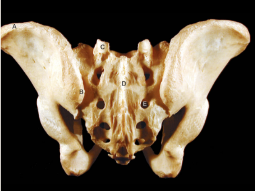 <p>Identify the structures of the Sacrum &amp; Coccyx with Ilium - Posterior View</p>