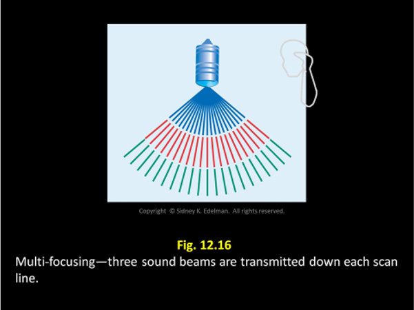 <p>The pattern with the ___ amount of curvature will have the deepest focus.</p>