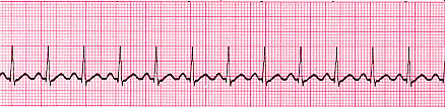 <p>More than 100 bpm.</p>
