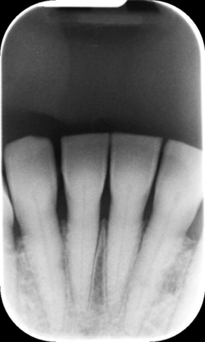 <p>What is this error?</p>