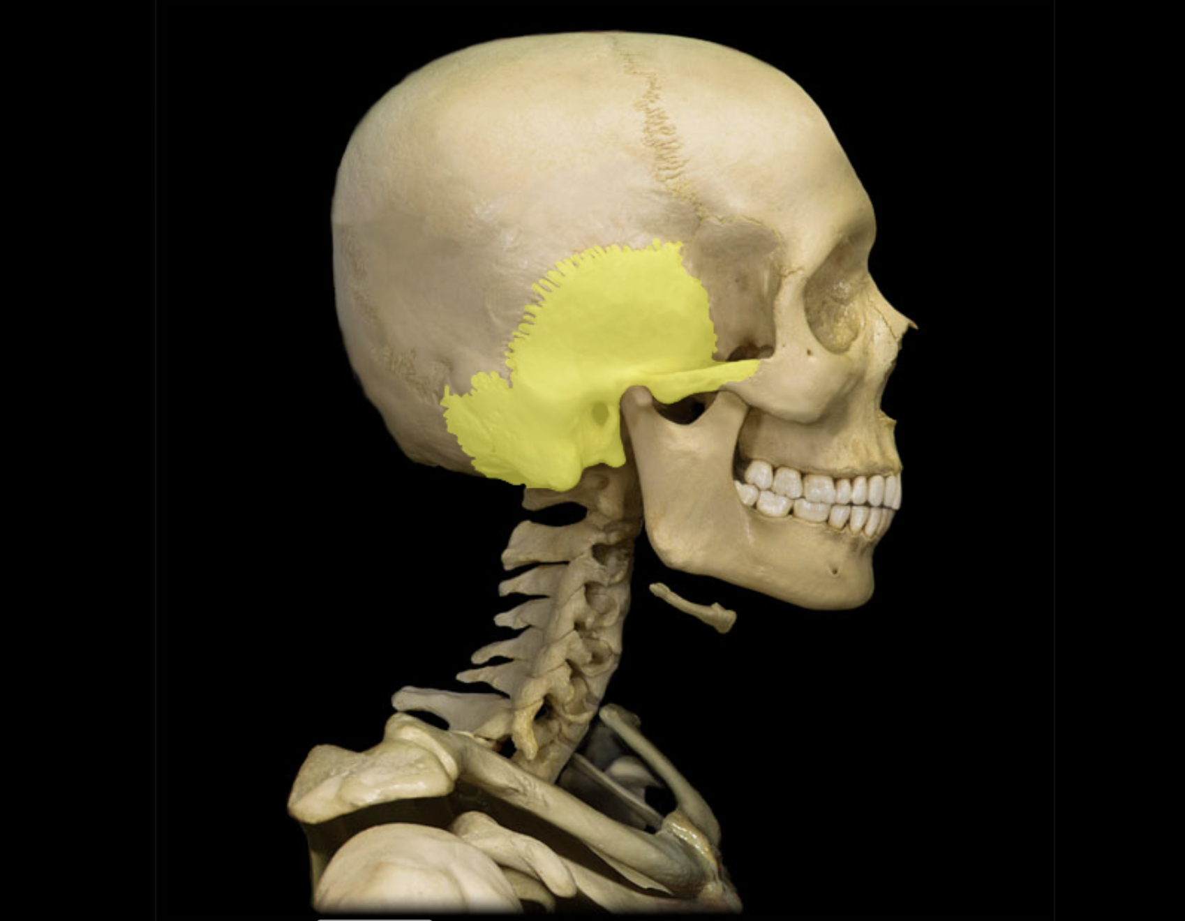 <p>Temporal bone</p>