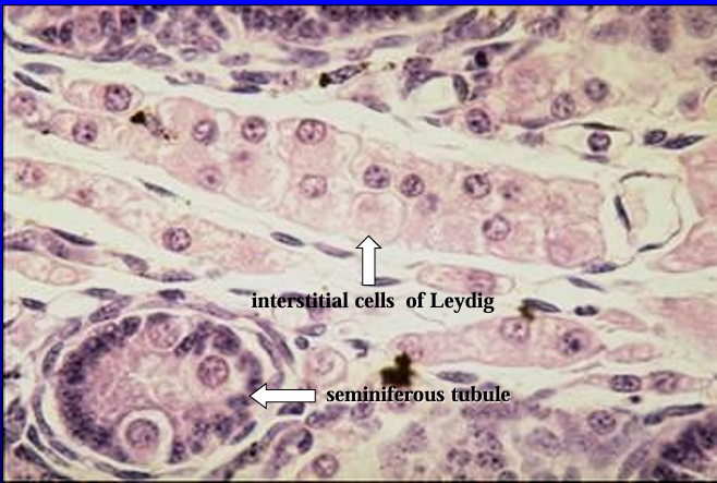 <p>Interstitial tissue of testis of 1-day-old pig. </p><p>The interstitial cells are<strong> abundant in the porcine testis.</strong></p><p>These cells exhibit an acidophilic and vacuolated cytoplasm. A seminiferous tubule is cut transversely in the lower left section of the screen</p>