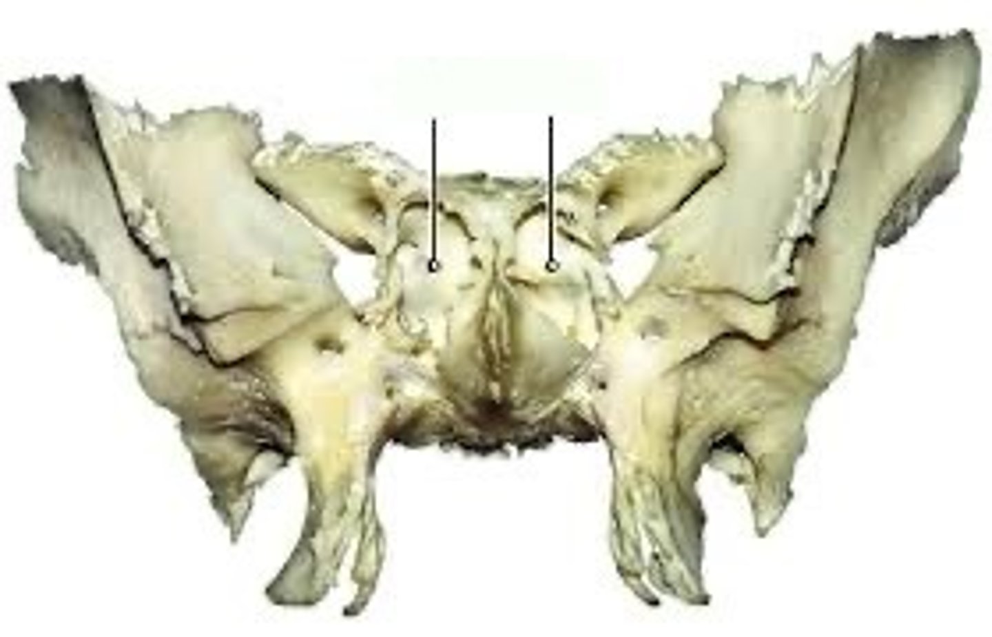 <p>What feature is this in the sphenoid? (Anterior)</p>