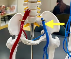 <p>Name the blood vessel.</p>