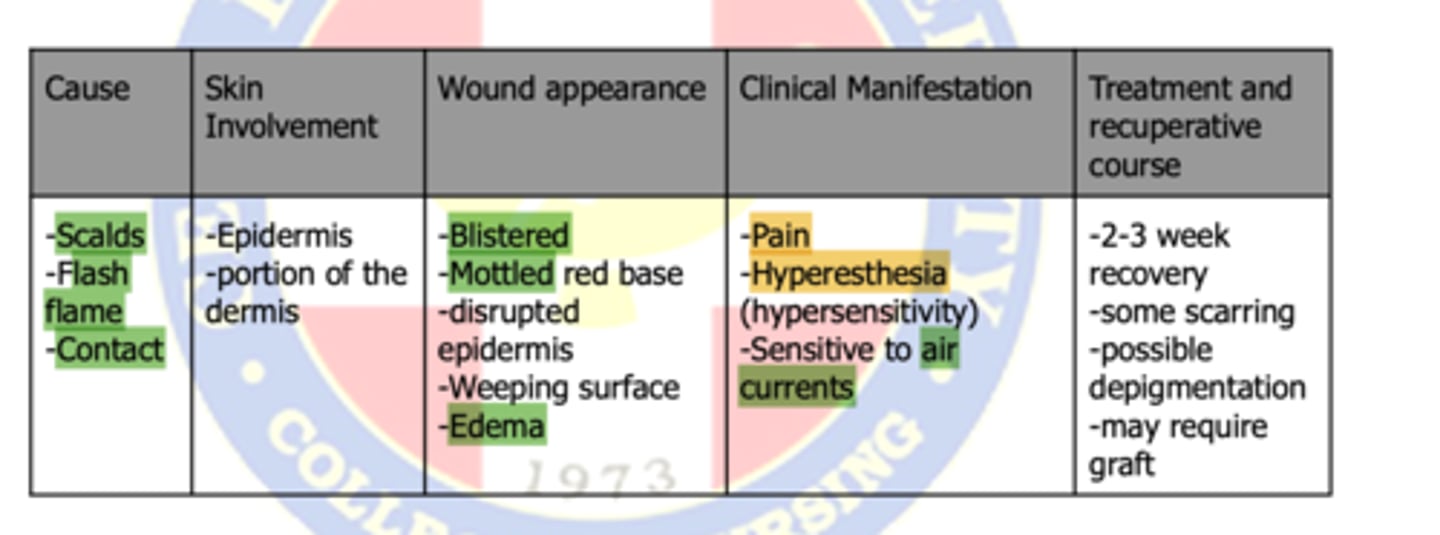 <p>partial thickness burns</p>