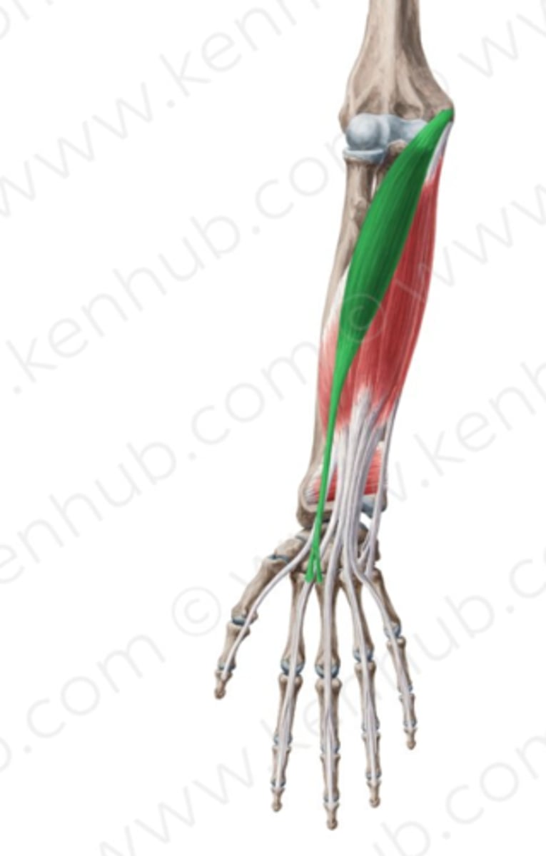 <p>Welke spier is dit?</p>