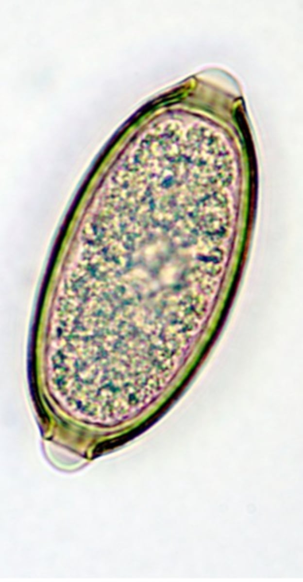 <p>Necropsy and careful examination of the mucosa of the digestive tract;</p><p>Microscopic examination of the mucosal scrapings -&gt; worms/eggs;</p><p>• Patent infections: detection of eggs in the faeces:</p>