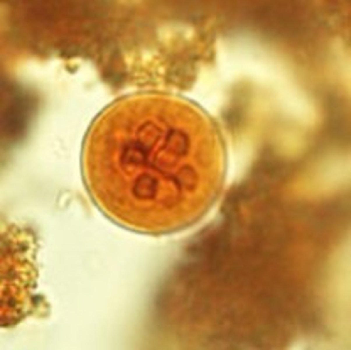 <p>Identify the parasite</p>