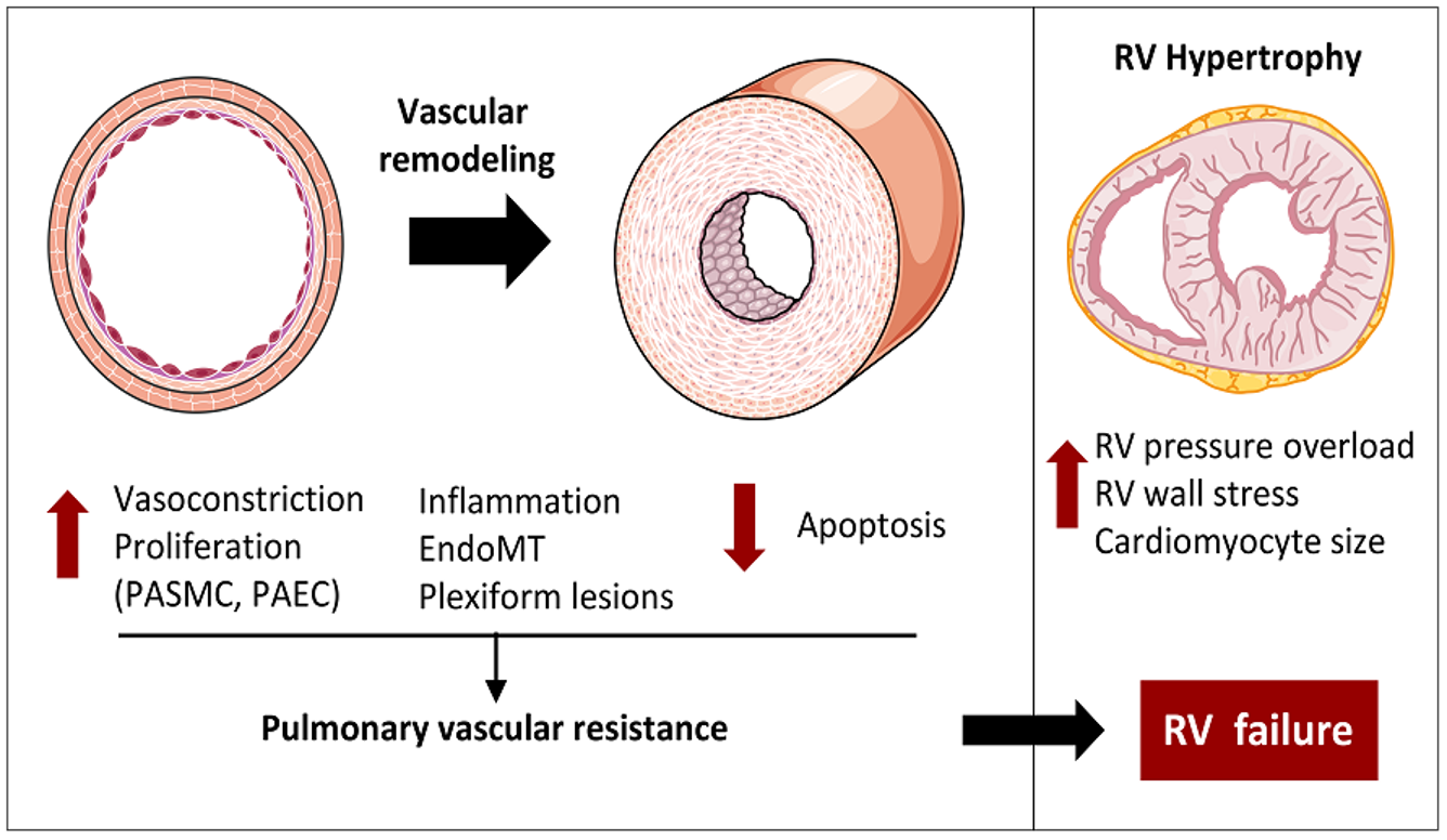 <p>Vascular remodeling</p>