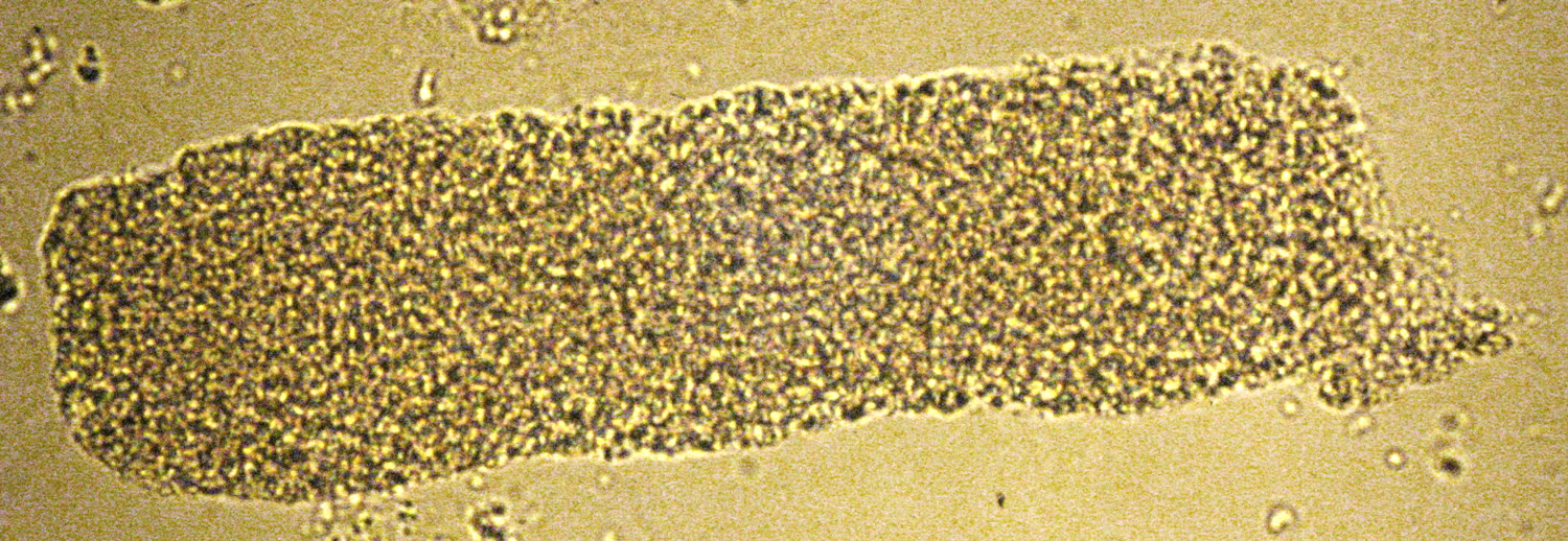 <p>Thought to be from breakdown of cellular cast components.</p><p>Progressive cellular deterioration leads to appearance of coarse granules which transition into fine granules.</p><p>Presence is associated with renal disease. </p>