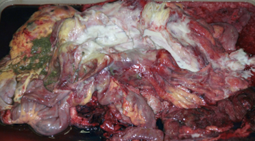 <p>Morphologic diagnosis </p>