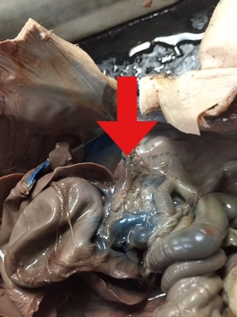 <p>soft, spongy organ between the stomach and the intestine</p>