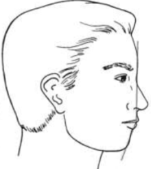 <p>what is this facial profile </p>