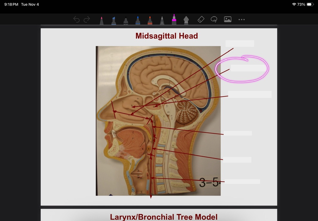 <p>What is this?</p>