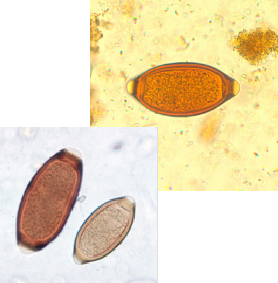 <p><span>What is the genus and stage of this parasite?</span></p>