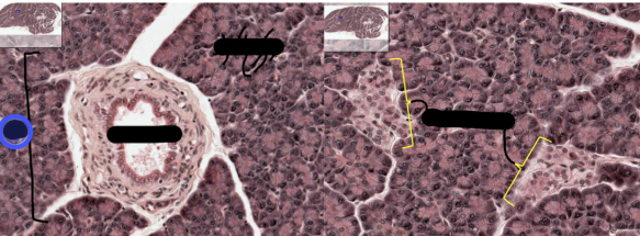 <p>what is this a histology of?</p>