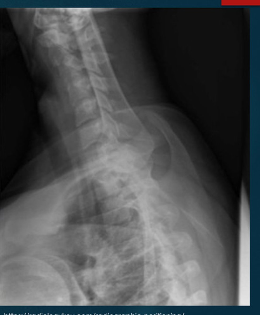 <p>What projection view is this?</p>