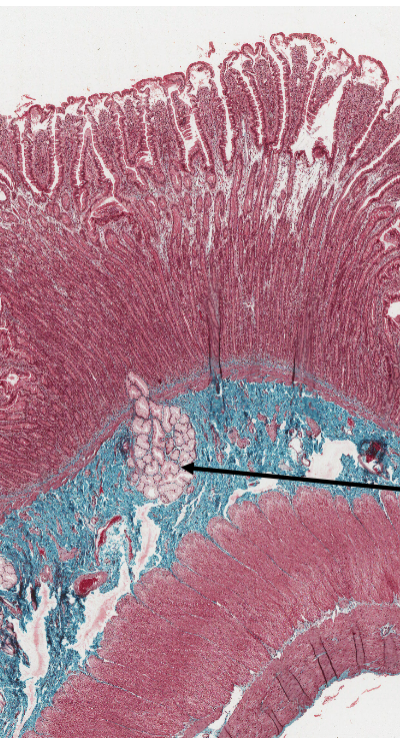 <p>What is the structure marked by an arrow in the duodenum?</p>