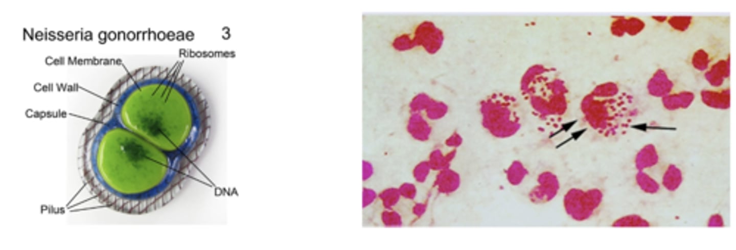 <p>What is the manifestation of Neisseria gonorrhoeae infection in men vs women?</p>