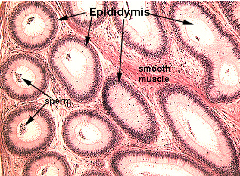 <p class=""><strong>Epididymis</strong></p><ul><li><p class=""><strong>Long, coiled duct</strong> with a <strong>regular, round lumen</strong></p></li><li><p class=""><strong>Cytoplasm has no nuclei in it (unlike seminif. tubules)</strong></p></li><li><p class="">Lined by <strong>pseudostratified columnar epithelium</strong> with <strong>stereocilia</strong></p></li><li><p class="">Surrounded by <strong>smooth muscle</strong></p></li><li><p class=""><strong>Sperm</strong> often visible in the lumen</p></li></ul><p class=""></p><p></p>