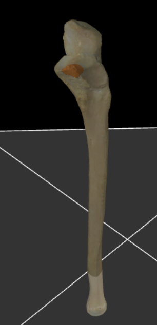 <p>Het naar ventraal uitspringende deel van de epifyse dat bij gebogen elleboog in de fossa coronoidea van de humerus past.</p>