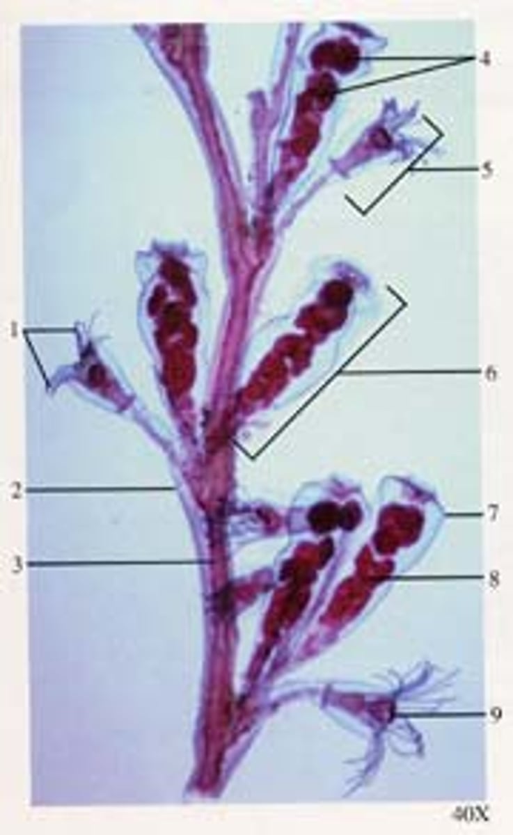<p>Which type of Obelia polyp is #6 referring to?</p>