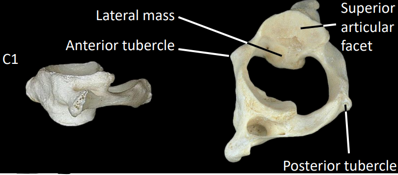 <p>no spinal body</p><p>anterior/posterior tubercle</p><p>large lateral mass (each side) to support occipital condyles</p>