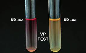 <p>VP- Voges Proskauer test </p>
