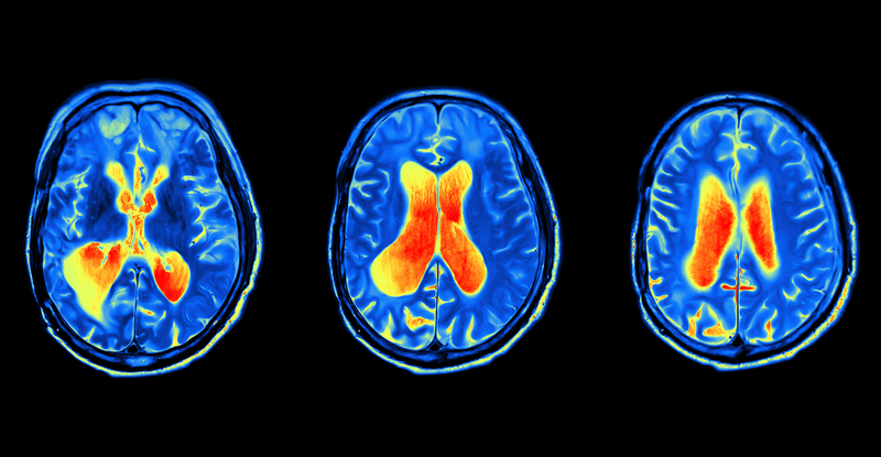 <p>neuroimaging technique used to measure brain activity by detecting changes in blood flow and oxygen levels</p>