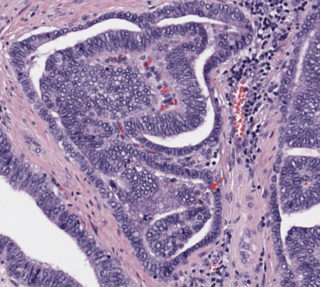 <p>Prostate</p>