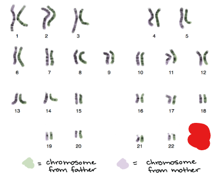 <p>Any chromosome that is not a sex chromosome. In the context of humans the other 44 ones.</p><p>The picture attached outlines the _______ present in humans.</p>
