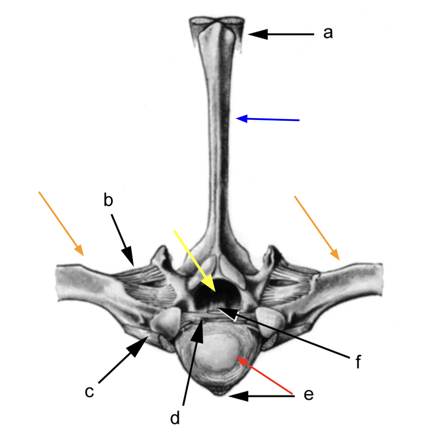 <p>What part of the vertebrae is represented by the yellow arrow?</p>