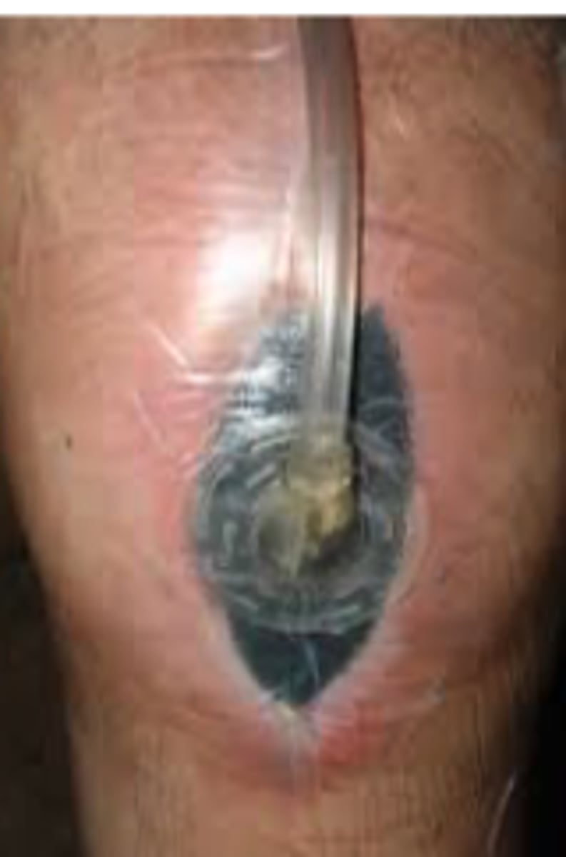 <p>Macrostrain and microstrain</p>